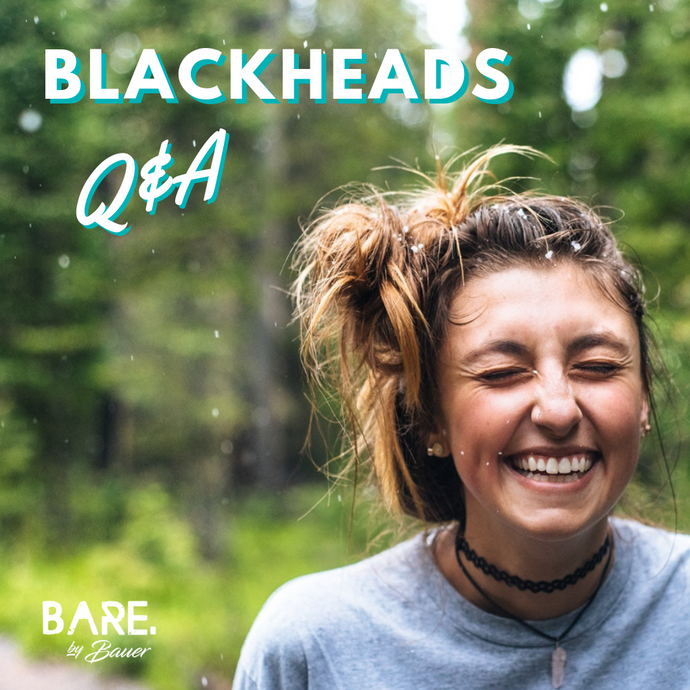 How do I get rid of blackheads?!